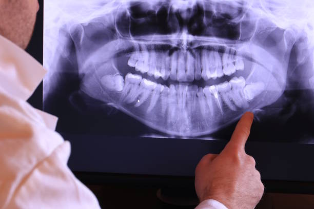 Best Emergency Care for Gum Disease in Ivanhoe, CA