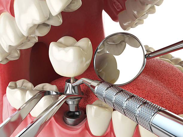 Best Emergency Orthodontic Repairs in Ivanhoe, CA